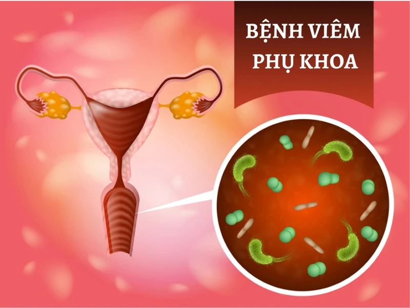 Hình ảnh nổi mụn ở vùng kín nữ: Nguyên nhân và cách khắc phục